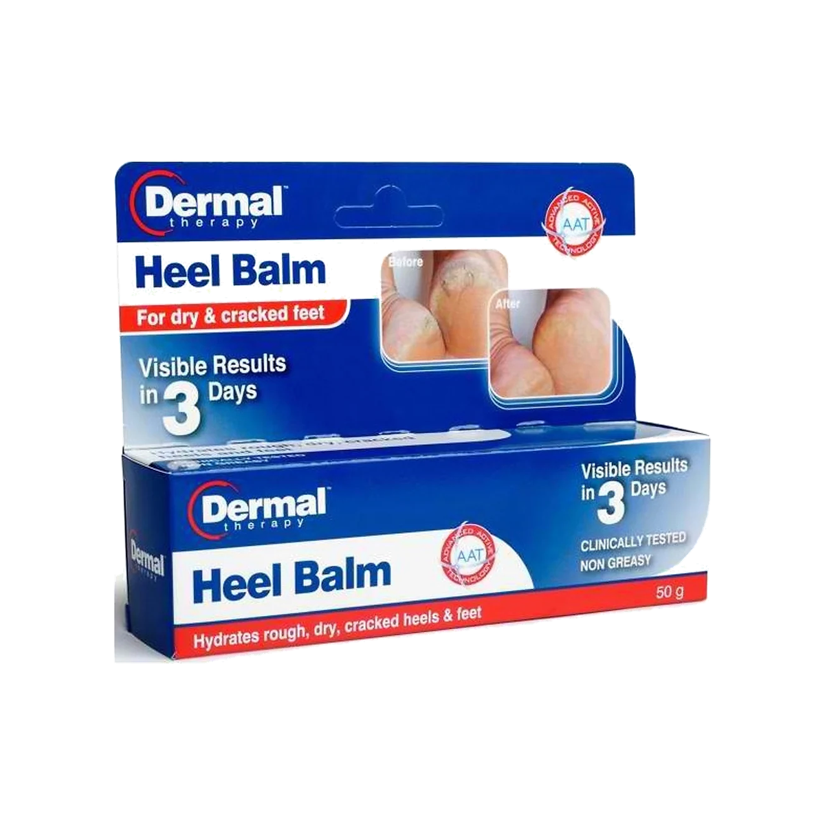 Dermal Therapy Heel Balm 50g