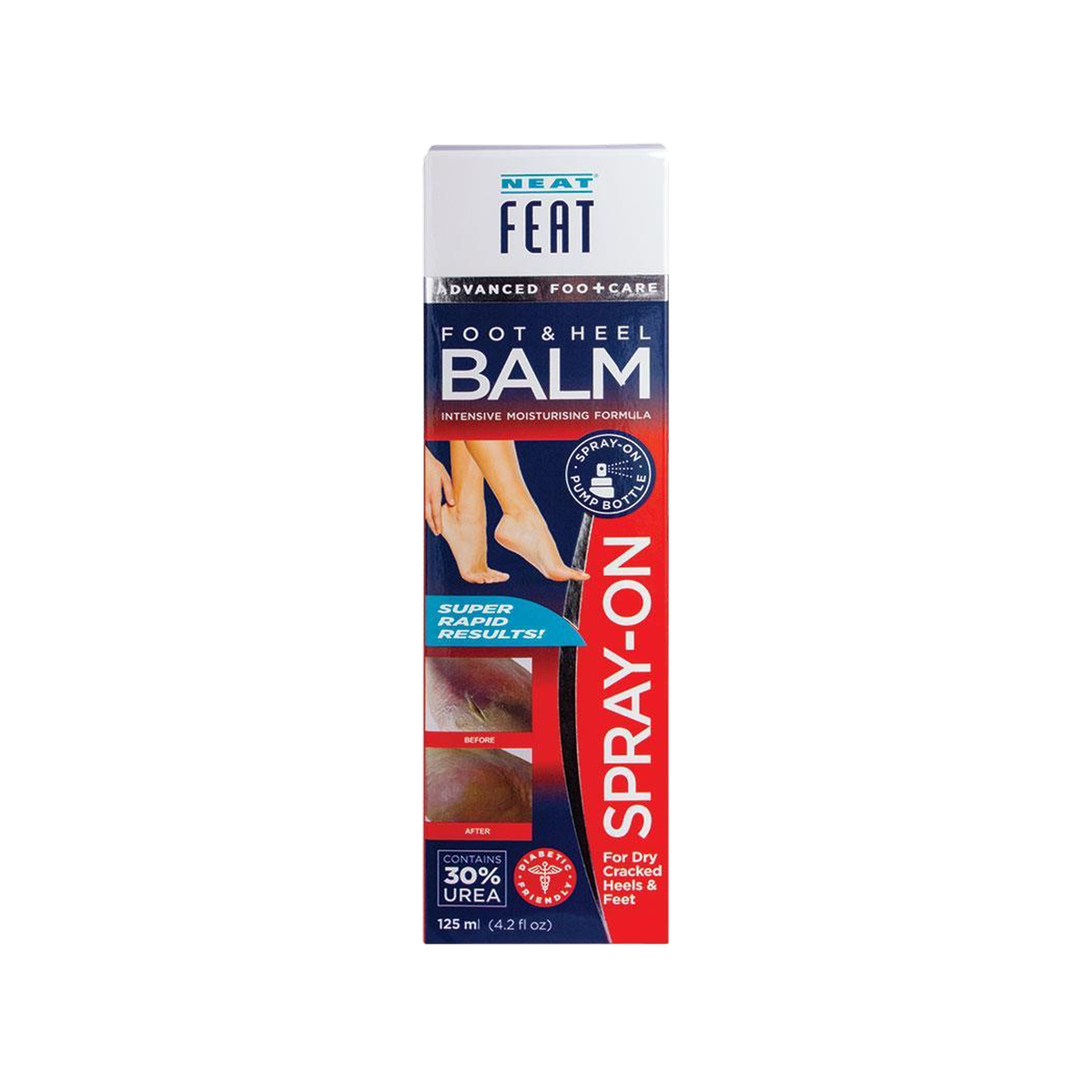 Neat Feat Heel Balm Spray 125mL